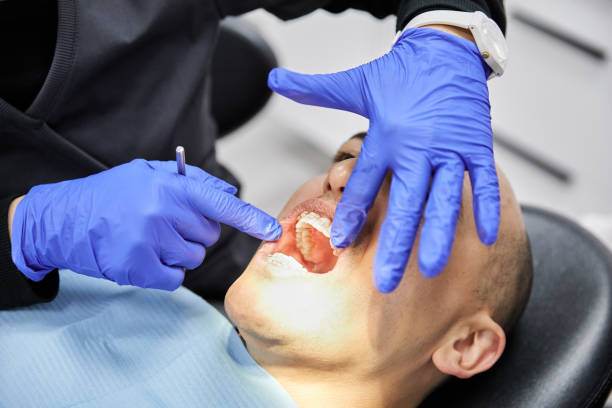 Best Emergency Dental Care for Broken or Chipped Teeth in Guadalupe, CA